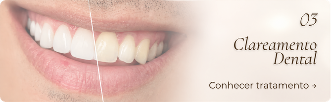 Clareamento Dental